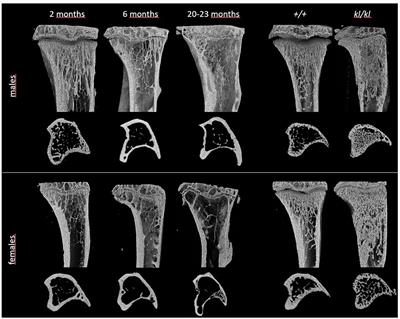 Relationship of the bone phenotype of the Klotho mutant mouse model of accelerated aging to changes in skeletal architecture that occur with chronological aging